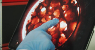 Eine Hand deutet auf eine Petrischale