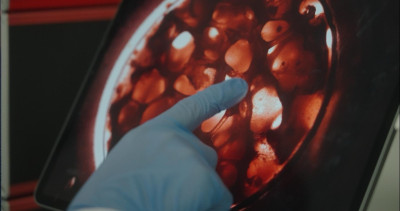 Eine Hand deutet auf eine Petrischale